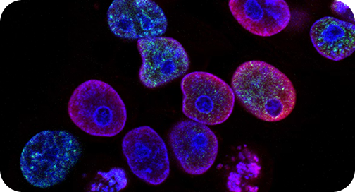 Oncologie — profilul molecular al tumorii