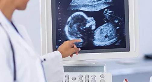 Screening prenatal